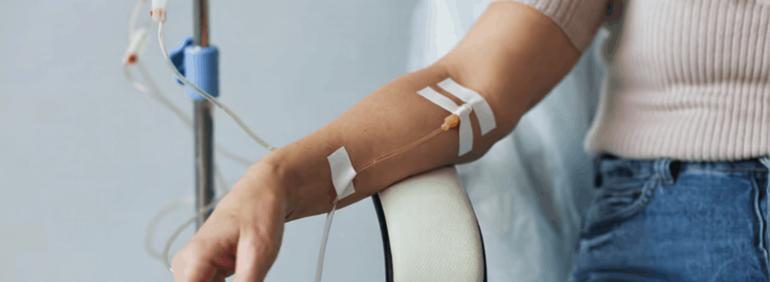 How Long Does an IV Hangover Treatment Take? What to Expect